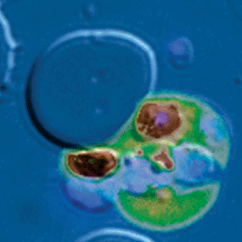 Image: A P. falciparum parasite exits a host erythrocyte loaded with the calcium concentration indicator. High fluorescence of the calcium indicator indicates increased calcium concentration within the host cell. The image is pseudocolored, tending from black (the lowest calcium concentration), through green and yellow to red (the highest calcium concentration) to indicate relative calcium concentration within the host cell. Increased calcium induces calpain activation at the time of parasite egress, as a consequence of upstream host cell signaling. The nuclei of daughter parasites are stained blue in a diagonal pattern from the upper right to the lower left as the parasites are actively exiting the cell. The host cell is no longer uniformly circular since it has been lysed. This shows a high concentration of calcium within the host cell at the end of the parasite cycle, when the host cell lyses and necessary for host calpain activation and break down of the host cytoskeleton (Photo courtesy of Doron Greenbaum, PhD, Perelman School of Medicine, University of Pennsylvania).